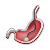 Endoscopia Digestiva